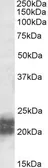 Anti-NPC2 antibody, Internal used in Western Blot (WB). GTX88174