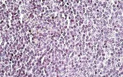 Anti-AIM2 antibody, C-term used in IHC (Paraffin sections) (IHC-P). GTX88186