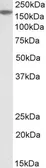Anti-EVI1 antibody, Internal used in Western Blot (WB). GTX88191