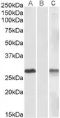 Anti-DYDC1 antibody, Internal used in Western Blot (WB). GTX88205