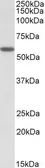 Anti-DIXDC1 antibody, Internal used in Western Blot (WB). GTX88233