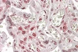 Anti-MLX antibody, Internal used in IHC (Paraffin sections) (IHC-P). GTX88235