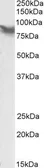 Anti-LPP antibody, Internal used in Western Blot (WB). GTX88236