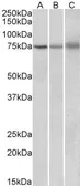 Anti-KLHL6 antibody, Internal used in Western Blot (WB). GTX88252