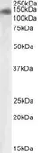 Anti-PLA2R1 antibody, Internal used in Western Blot (WB). GTX88257
