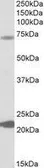 Anti-KCNN2 antibody, Internal used in Western Blot (WB). GTX88269