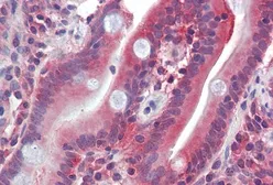 Anti-GLUT5 antibody, C-term used in IHC (Paraffin sections) (IHC-P). GTX88331