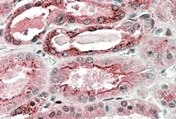Anti-GGCX antibody, C-term used in IHC (Paraffin sections) (IHC-P). GTX88337