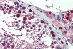 Anti-PREX1 antibody, Internal used in IHC (Paraffin sections) (IHC-P). GTX88346