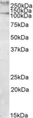 Anti-Talin-1 antibody, Internal used in Western Blot (WB). GTX88357