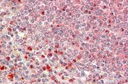 Anti-UBR4 antibody, C-term used in IHC (Paraffin sections) (IHC-P). GTX88365