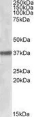 Anti-SUMF1 antibody, Internal used in Western Blot (WB). GTX88370