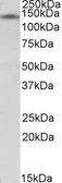 Anti-RIP140 antibody, Internal used in Western Blot (WB). GTX88376