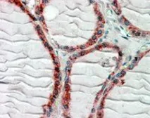 Anti-CLIP170 antibody, C-term used in IHC (Paraffin sections) (IHC-P). GTX88382