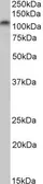 Anti-PSD95 antibody, Internal (near C-Terminus) used in Western Blot (WB). GTX88388