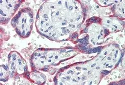Anti-NOX2 / gp91phox antibody, Internal used in IHC (Paraffin sections) (IHC-P). GTX88404