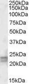 Anti-ARL4D antibody, Internal used in Western Blot (WB). GTX88455