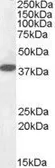 Anti-Laforin antibody, Internal used in Western Blot (WB). GTX88479