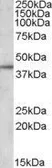 Anti-Apolipoprotein L3 antibody, C-term used in Western Blot (WB). GTX88512