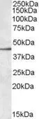 Anti-SIGLEC8 antibody, Internal used in Western Blot (WB). GTX88527