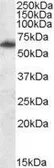 Anti-FTO antibody, Internal used in Western Blot (WB). GTX88551