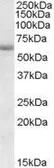 Anti-CDH23 antibody, Internal used in Western Blot (WB). GTX88601