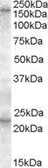 Anti-SUR1 antibody, C-term used in Western Blot (WB). GTX88616