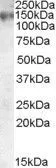 Anti-MRP1 antibody, Internal used in Western Blot (WB). GTX88617