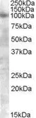 Anti-FGFR2 antibody, Internal used in Western Blot (WB). GTX88618