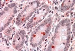 Anti-GNAT3 antibody, Internal used in IHC (Paraffin sections) (IHC-P). GTX88624