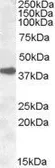 Anti-ERCC1 antibody, N-term used in Western Blot (WB). GTX88627