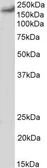 Anti-Cav1.2 antibody, C-term used in Western Blot (WB). GTX88630