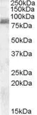 Anti-ZRANB1 antibody, C-term used in Western Blot (WB). GTX88665