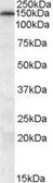 Anti-MRP5 antibody, N-term used in Western Blot (WB). GTX88691