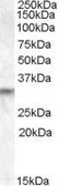 Anti-PRUNE2 antibody, Internal used in Western Blot (WB). GTX88724