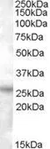 Anti-RASSF3 antibody, C-term used in Western Blot (WB). GTX88778