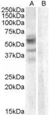 Anti-Arylsulfatase D antibody, Internal used in Western Blot (WB). GTX88781