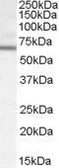 Anti-DACH2 antibody, Internal used in Western Blot (WB). GTX88789