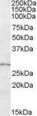 Anti-LYPLAL1 antibody, Internal used in Western Blot (WB). GTX88793