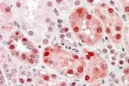 Anti-DNMT1 antibody, Internal used in IHC (Paraffin sections) (IHC-P). GTX88801