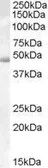 Anti-ACTL7B antibody, Internal used in Western Blot (WB). GTX88858