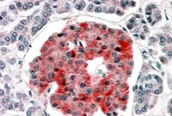 Anti-Kir6.2 antibody, Internal (near the N-term) used in IHC (Paraffin sections) (IHC-P). GTX88908