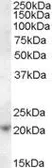 Anti-ASF1A antibody, C-term used in Western Blot (WB). GTX88909
