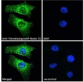 Anti-FGF21 antibody, Internal used in Immunocytochemistry/ Immunofluorescence (ICC/IF). GTX88943