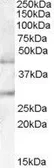 Anti-B3GNT2 antibody, Internal used in Western Blot (WB). GTX88963