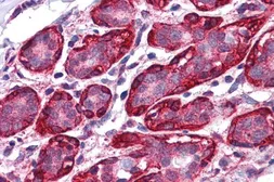 Anti-Thyroid Hormone Receptor alpha antibody, Internal used in IHC (Paraffin sections) (IHC-P). GTX88977