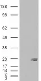Anti-SAR1B antibody, Internal used in Western Blot (WB). GTX88997