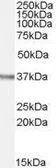 Anti-Ogg1 antibody, Internal used in Western Blot (WB). GTX89012