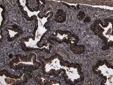 Anti-CD26 antibody, Internal used in IHC (Paraffin sections) (IHC-P). GTX89027