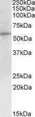 Anti-G6PD (aa 305 - 318) antibody, Internal used in Western Blot (WB). GTX89073